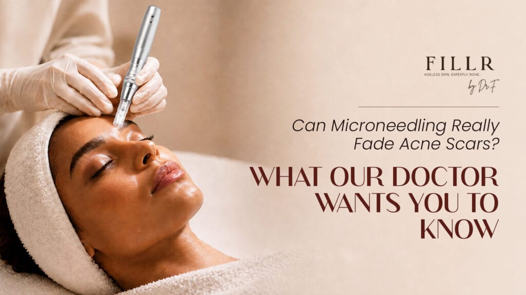 Microneedling